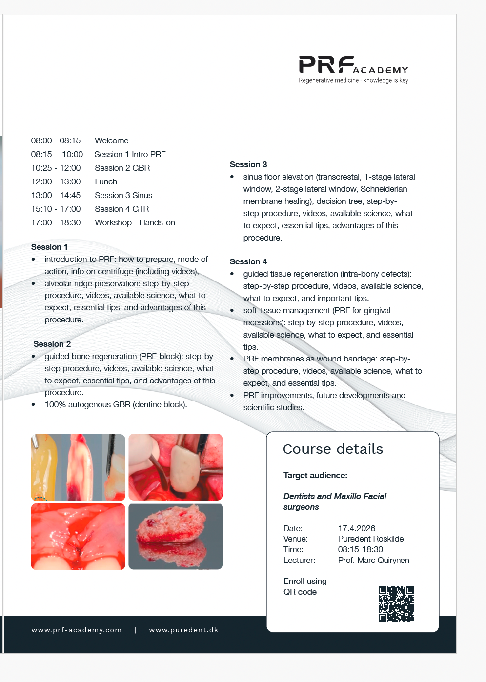 17/4 PA07 PRF in Dentistry i Roskilde